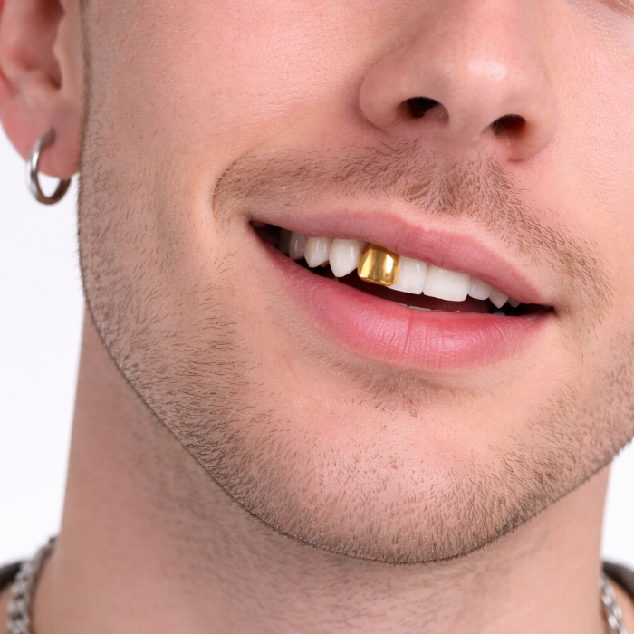 gebit-gouden-tand-1