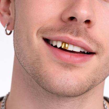 gebit-gouden-tand-1